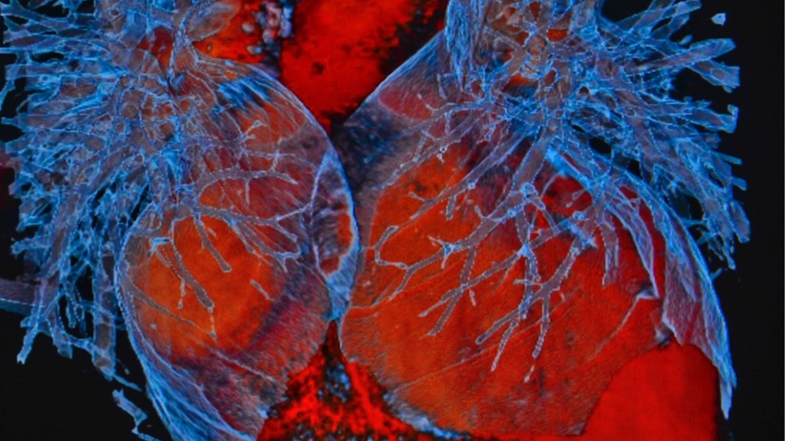Valve & Structural Heart Disease Clinic