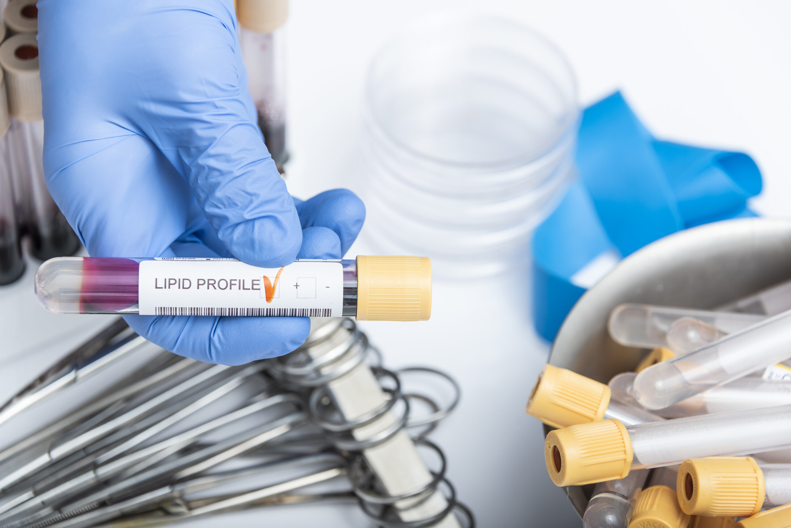 New England Journal of Medicine Article Highlights, Obicetrapib, a New Cholesterol-Lowering Drug for High-Risk Heart Patients